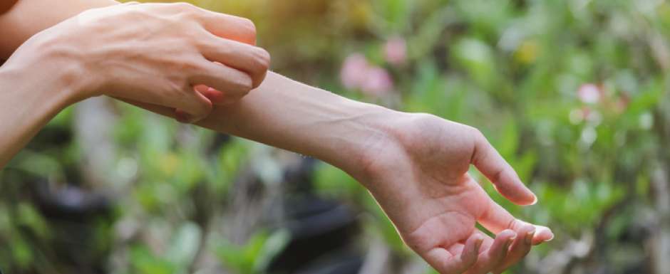 Gommer les symptômes de l'eczéma avec l'alimentation
